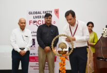 #GlobalNASHDay #FattyLiver #SGPGIMS #LucknowNews #HealthNews #LiverDisease #MASH #NASHAwareness #MedicalNews #IndiaHealth #UPNews #DoctorConference,फैटी लिवर जागरूकता कार्यक्रम, NASH बीमारी जानकारी, SGPGIMS कार्यक्रम, डॉक्टर फैटी लिवर चर्चा, Global NASH Day event, fatty liver awareness campaign, liver disease prevention India, hepatology conference Lucknow,ग्लोबल NASH दिवस, फैटी लिवर रोग, NASH बीमारी, MASH disease, SGPGIMS लखनऊ, liver disease India, fatty liver awareness, metabolic liver disease, diabetes fatty liver link, obesity liver disease, Global NASH Day 2026, SGPGI hepatology news, Uttar Pradesh health news, Lucknow medical news,